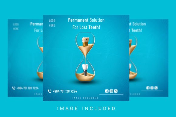 Download Dental Implantation Social Media Post - Social media Collection